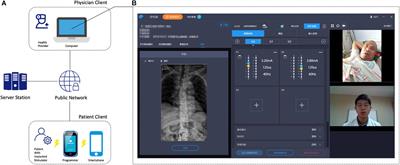 Management of Intractable Pain in Patients With Implanted Spinal Cord Stimulation Devices During the COVID-19 Pandemic Using a Remote and Wireless Programming System